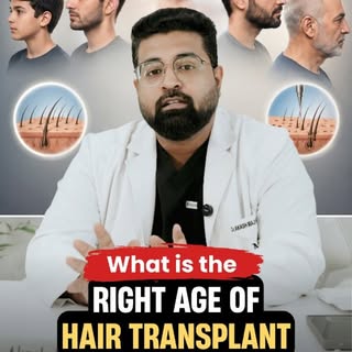Is there a right age for a hair transplant? 👨‍⚕️ 
The answer depends on your hair loss pattern, not