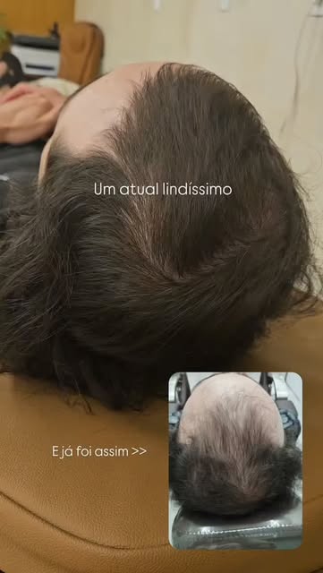Esse resultado é consequência de diagnóstico preciso, protocolo individualizado e acompanhamento. ✨️