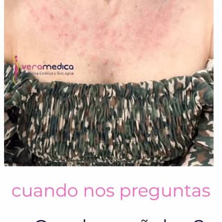 A veces, para regenerar la piel… primero hay que activarla ✨

Estas pequeñas marcas son normales tra
