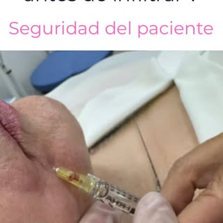 ¿Por qué aspiramos antes de infiltrar?💉🩸

Un gesto que apenas dura unos segundos puede marcar la d
