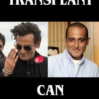 Still worrying about hair loss issues ? 
Get a hair transplant done 
It has transformed many lives 
