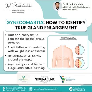 Gynecomastia is not just fat — true glandular enlargement doesn’t respond to workouts. Proper evalua