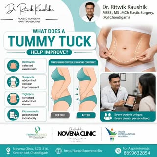 Abdominoplasty, also known as a tummy tuck, is a body contouring procedure used to address excess ab