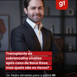 O transplante de sobrancelha voltou ao debate público após a repercussão recente envolvendo a Boca R