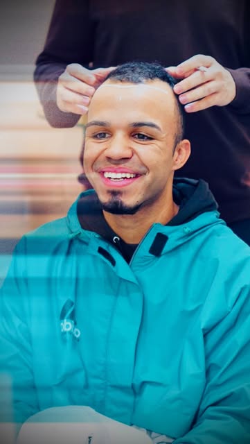 Aos 22 anos, ele decidiu dar um novo passo e realizar seu transplante capilar no Instituto Almeida.
