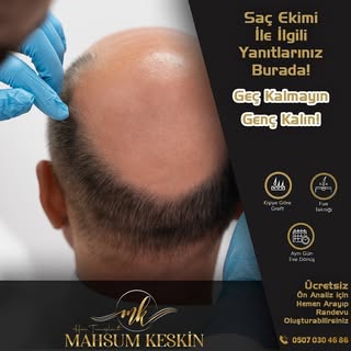Saç ekimi hakkında bize danışın! 

ÖMÜR BOYU GARANTİLİ EKİM
➡️KESİN SONUÇ GARANTİSİ
➡️SINIRSIZ GREFT