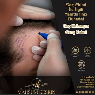 Saç ekimi için geç kalmayın! 

ÖMÜR BOYU GARANTİLİ EKİM
➡️KESİN SONUÇ GARANTİSİ
➡️SINIRSIZ GREFT
DET