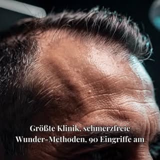 Nicht jede Haartransplantation braucht dieselbe Methode
 
Der Markt rund um Haartransplantationen is