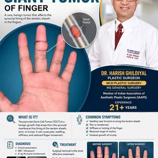 tenosynovial giant cell tumor (TGCT) is a rare, usually non-cancerous tumor that grows in the soft t