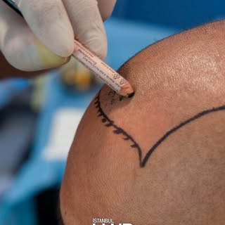 Our focus is always on two key principles: flawless medical application and the most natural-looking
