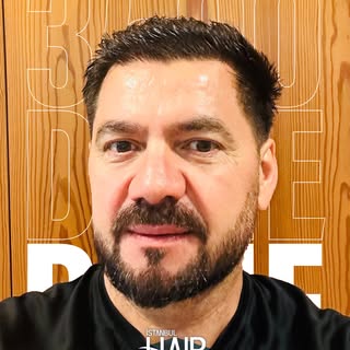 Maximum density, maximum confidence! 🔥 Check out this incredible result achieved with 3,500 grafts.