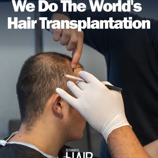 Global Standards, Personalized Excellence for Every Patient. 🌍

At Istanbul Hair Center, we are pro