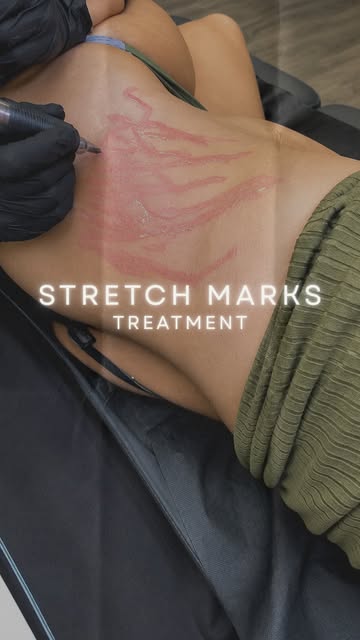 True skin revision requires a clinical approach that goes beneath the surface.

What you are seeing 