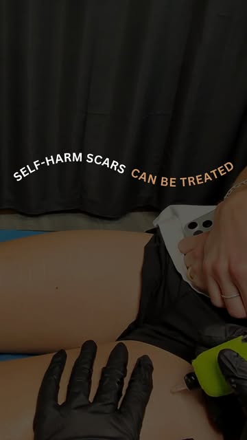 Your scars tell a story, but you have the power to decide how visible that story remains.

For clien