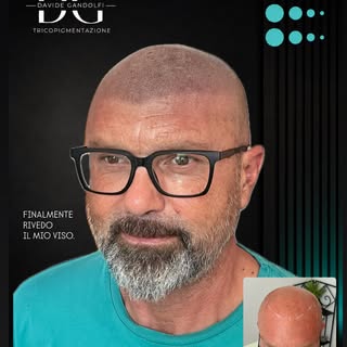 FINALMENTE RIVEDO IL MIO VISO.

Queste sono state le parole del mio ultimo cliente dopo aver complet