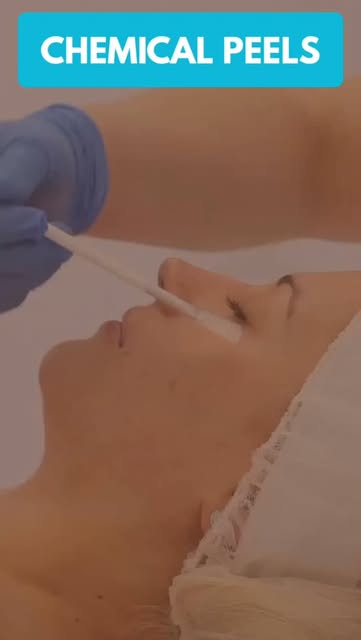#chemicalpeel#