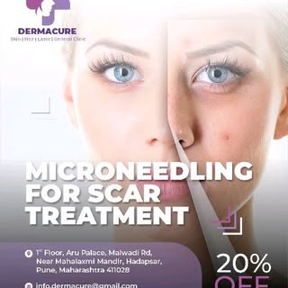 DERMACURE💜
 SKIN.HAIR.LASER.GENERAL CLINIC 💫🌸
#microneedling 
#mnrftreatmentforacnescar 
#growthf