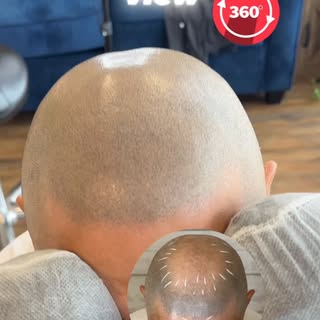 Lets have a look around view of SMP…#scalpmicropigmentation #hairloss #creativescalps #smp #hairtatt