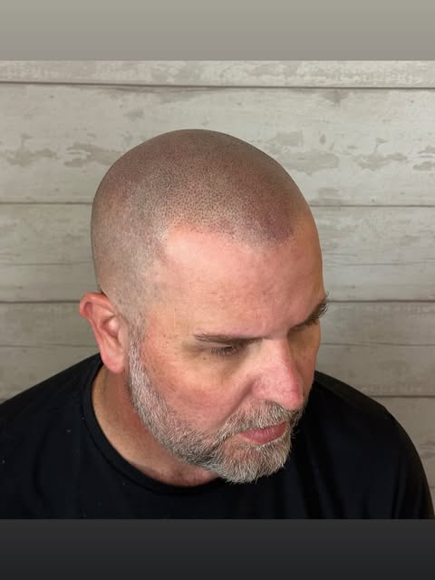 Creative Scalps Faded Hairline. Bishop Shades 8-9-7 used to complete this amazing result. #smp #crea