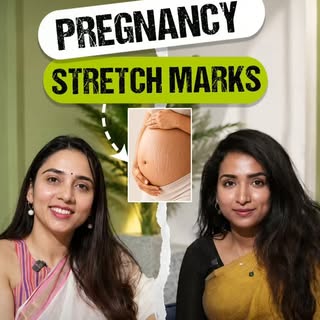 Stretch Marks During Pregnancy? 🤰✨

Here’s what every mom-to-be should know.

Stretch marks are a c