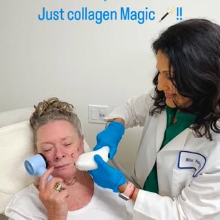 Sofwave uses ultrasound to stimulate your body’s natural collagen, tightening and lifting skin with 