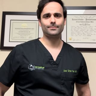 El trasplante de cabello es la alternativa que te permitirá crecer tu cabello nuevamente en un área 