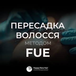 Пересадка волосся методом FUE.

Що таке трансплантація волосся FUE? 
Це 3D-відео пояснює, що спричин