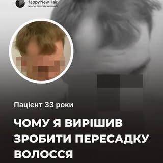 Чому я вирішив зробити пересадку волосся...

Наш пацієнт 33 років розповідає про свою мотивацію, дра