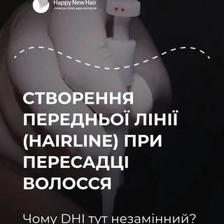 Чому «ляльковий» hairline залишився в минулому? Секрети природної пересадки волосся методом DHI ✂️

