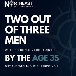 Most men assume hair loss is just genetics.⁠
But stress, illness, hormones, nutrition, and lifestyle