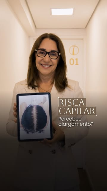 A risca do cabelo pode ser o primeiro sinal da calvície feminina.

Você percebeu que sua risca está 