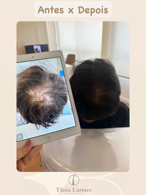 Resultado que merece ser visto de todos os ângulos.

Neste resultado masculino, a evolução da cobert