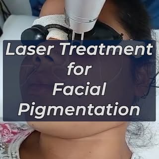 Tired of stubborn facial pigmentation, dark spots, and uneven skin tone? 
Advanced laser treatment h