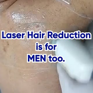 Think laser hair removal is just for women? Think again! More men than ever are choosing Laser Hair 