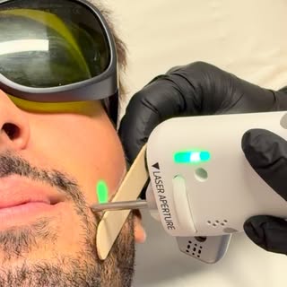 ⚡️ÉPILATION LASER : comment se déroule une séance ?

Sur cette vidéo, vous pouvez observer le faisce