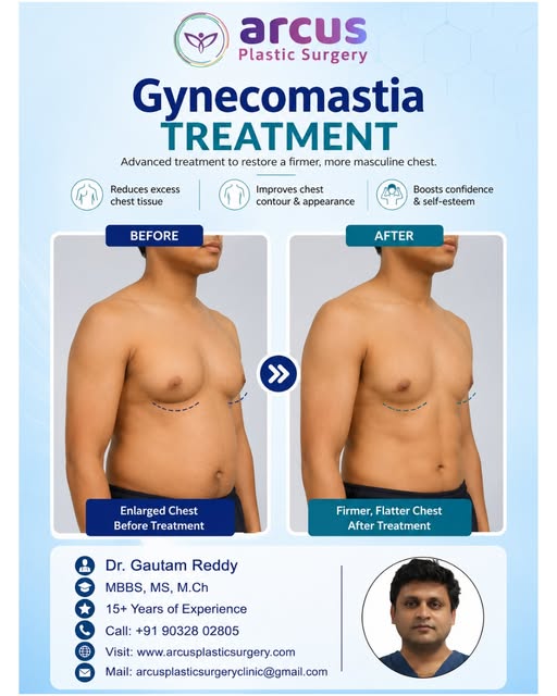 Rating: 5.0 ⭐⭐⭐⭐⭐
✨ Arcus Plastic Surgery✨
🔹 💪 Reduces Excess Chest Tissue
🔹 📐 Improves Chest Co