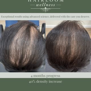 Did you know sweat is naturally alkaline, while a healthy scalp is slightly acidic? When sweat, oil,