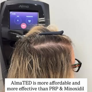 DM me to find out how you can get a DISCOUNTED AlmaTED package! 🫶🏼✨