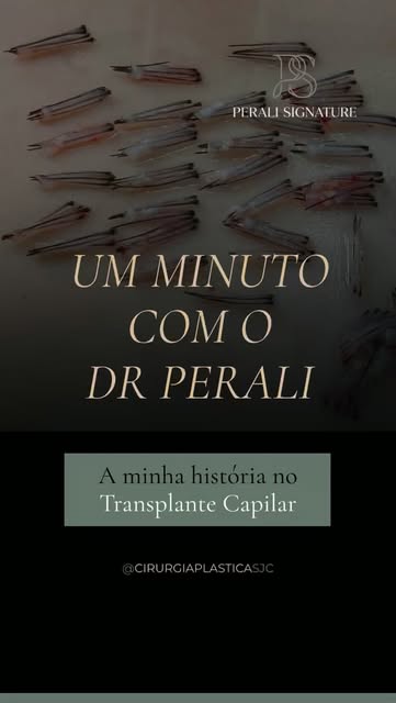 ⚜️Minha trajetória no transplante capilar começou com uma inquietação: não basta transplantar fios, 
