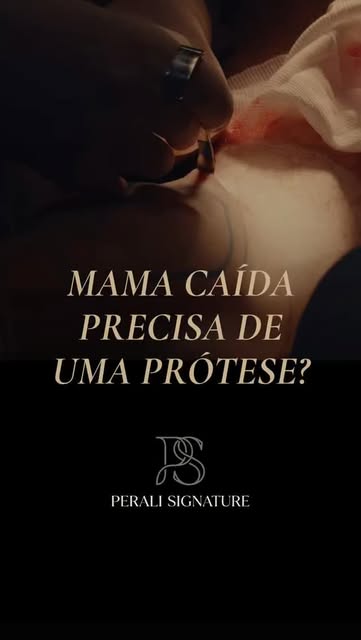 ⚜️Mama caída SEMPRE precisa de silicone? Verdade ou mentira?
🎥Assista até o final e tire suas dúvid