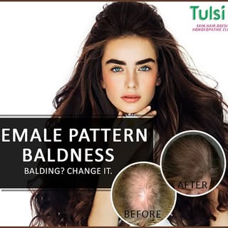 You snooze, you lose! 
Start your fight against female pattern baldness?

At The Tulsi Clinic, we un