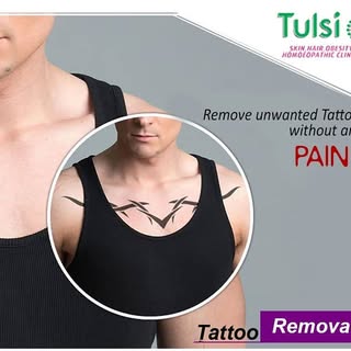 Nearly 30% of people have at least one tattoo. But not all of them are happy about their decision. 
