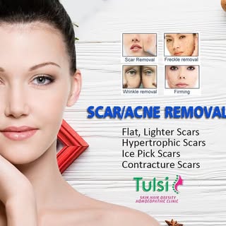 Won the battle with acne? Now enjoy smoother, clearer skin by treating and removing any leftover sca