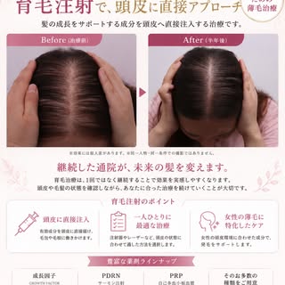 女性の薄毛・分け目のお悩みに。
育毛注射で、頭皮に直接アプローチ。

「分け目が以前より目立つ」
「髪のボリュームが減ってきた」
「抜け毛が増えた気がする」

女性の薄毛のお悩みは、年齢やライフスタイ