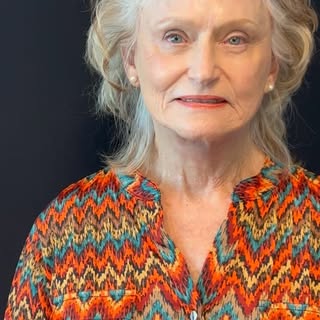 This is Carol one of my patients, she is 80 years old,  this video was taken 12 days after her face 