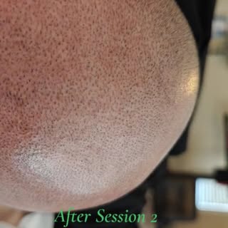 This was taken after the client's second session. He wanted a softer smp look. I used a dark brown p