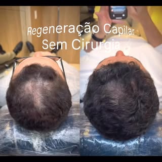 Você acredita que esta evolução aconteceu em apenas cinco sessões? 😉

Sim. E este é apenas o result