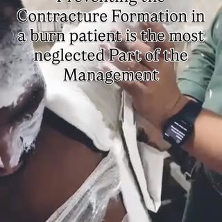 #hairtransplant #botox #liposuction #gynecomastia #laserhairremoval
