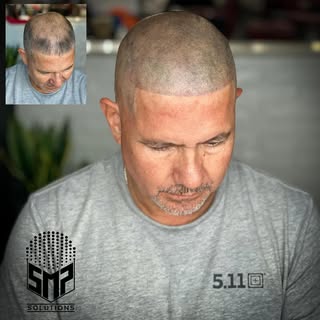 Client had previous work done from another company 

We helped the Gentleman get his confidence back