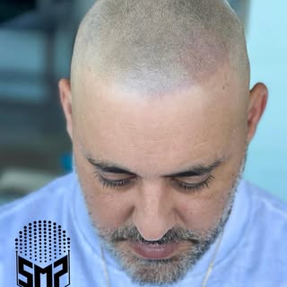 Scalp Micropigmentation is life changing for men and women 🙋🏻‍♂️🙋‍♀️

Swipe 👈 for before Smp 😳
